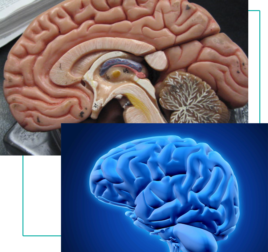 brain-tumor